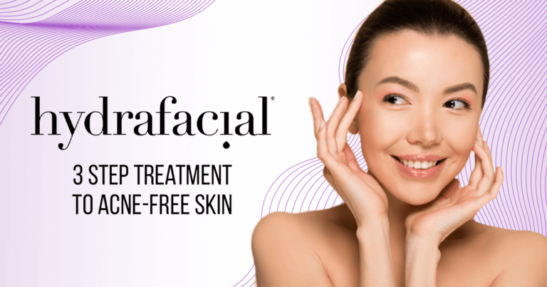 HydraFacial’s 3-Step Treatment to Acne-Free Skin